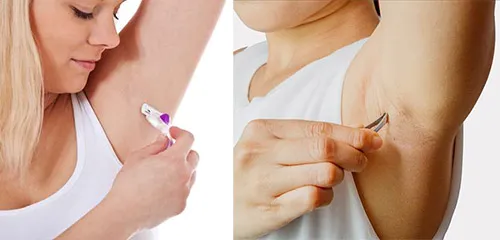 Hình ảnh một chiếc nhíp đang nhổ lông nách, thể hiện phương pháp tẩy lông nách tại nhà đơn giản và hiệu quả.