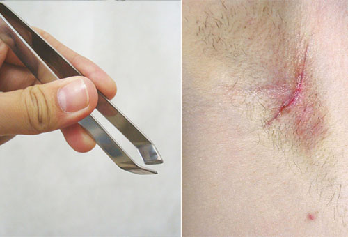 Một người phụ nữ kiểm tra lông nách của mình, minh họa cho cách làm đẹp nách và triệt lông an toàn