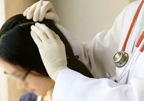 cần thăm khám chuyên gia y tế khi bị nấm da đầu