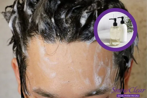 Dầu gội dược liệu chuyên dụng chứa Ketoconazole để diệt vi nấm da đầu.