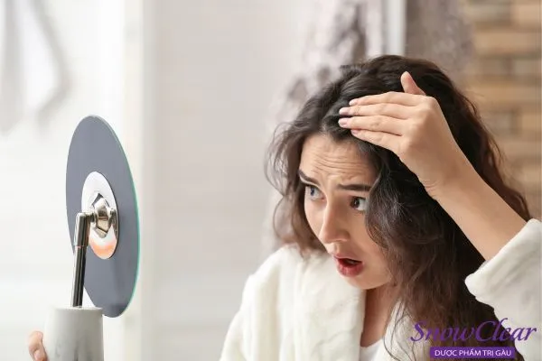 Hình ảnh tóc rụng không kiểm soát và yếu đi rõ rệt do sự tấn công của nấm.