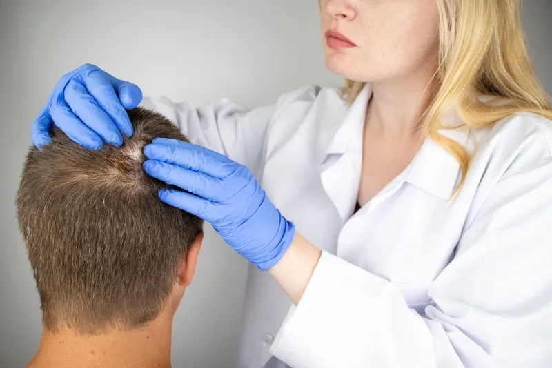 Bác sĩ tư vấn cách điều trị nấm da đầu hiệu quả