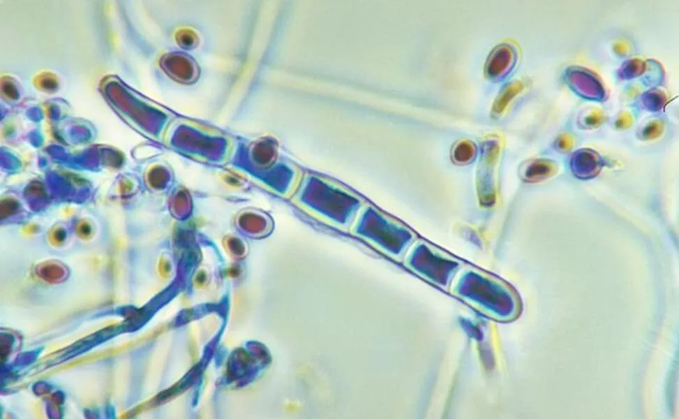 Cận cảnh nấm Trichophyton, nguyên nhân hàng đầu gây ra bệnh nấm da đầu bị ngứa chảy nước.